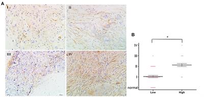 The Orexin-A-Regulated Akt/mTOR Pathway Promotes Cell Proliferation Through Inhibiting Apoptosis in Pancreatic Cancer Cells